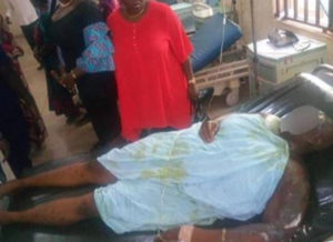 Angry man douses his wife with acid for demanding divorce in Anambra State